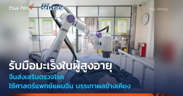 รับมือมะเร็งในผู้สูงอายุ จีนส่งเสริมตรวจโรค - ใช้ศาสตร์แพทย์แผนจีน บรรเทาผลข้างเคียง