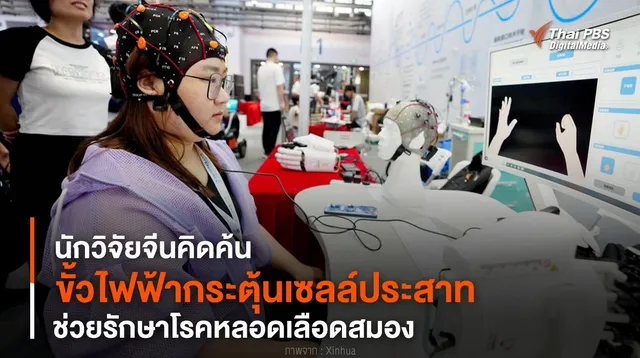 นักวิจัยจีนคิดค้น “ขั้วไฟฟ้ากระตุ้นเซลล์ประสาท” ช่วยรักษาโรคหลอดเลือดสมอง