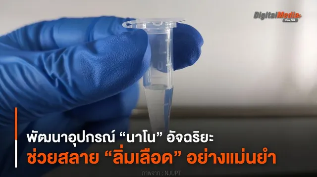 พัฒนาอุปกรณ์ “นาโน” อัจฉริยะ ช่วยสลาย “ลิ่มเลือด” อย่างแม่นยำ