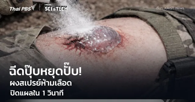 ฉีดปุ๊บหยุดปั๊บ! "ผงสเปรย์ห้ามเลือด" ปิดแผลใน 1 วินาที พลิกโฉมการกู้ชีพและลดการสูญเสีย