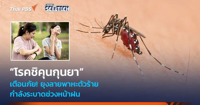 เตือนภัย! ยุงลายพาหะตัวร้าย “โรคชิคุนกุนยา” กำลังระบาดช่วงหน้าฝน 