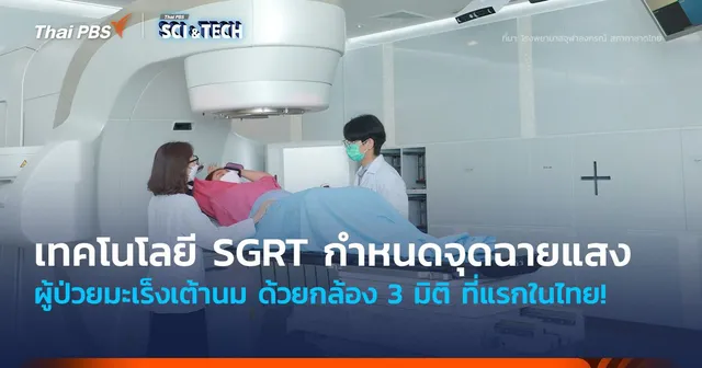 ที่แรกในไทย! นำเทคโนโลยี SGRT กำหนดจุดฉายแสงผู้ป่วยมะเร็งเต้านม ด้วยกล้อง 3 มิติ