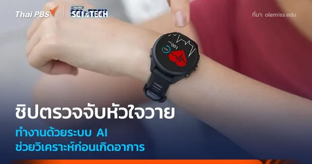 ชิปตรวจจับหัวใจวาย พลัง AI ช่วยวิเคราะห์ก่อนเกิดอาการ