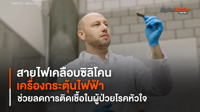 สายไฟเคลือบซิลิโคนสำหรับเครื่องกระตุ้นไฟฟ้า ช่วยลดการติดเชื้อในผู้ป่วยโรคหัวใจ