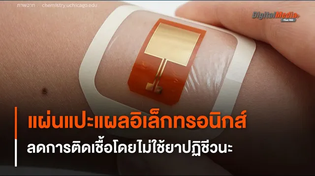 แผ่นแปะแผลอิเล็กทรอนิกส์ ลดการติดเชื้อรุนแรงโดยไม่ใช้ยาปฏิชีวนะ