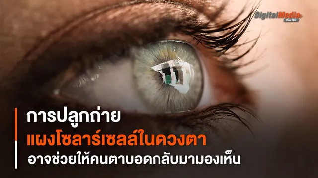 การปลูกถ่าย "แผงโซลาร์เซลล์" ในดวงตา อาจช่วยให้คนตาบอดกลับมามองเห็น