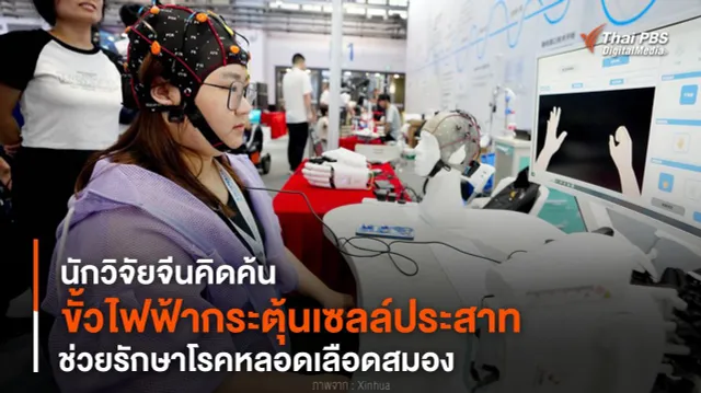 นักวิจัยจีนคิดค้น “ขั้วไฟฟ้ากระตุ้นเซลล์ประสาท” ช่วยรักษาโรคหลอดเลือดสมอง