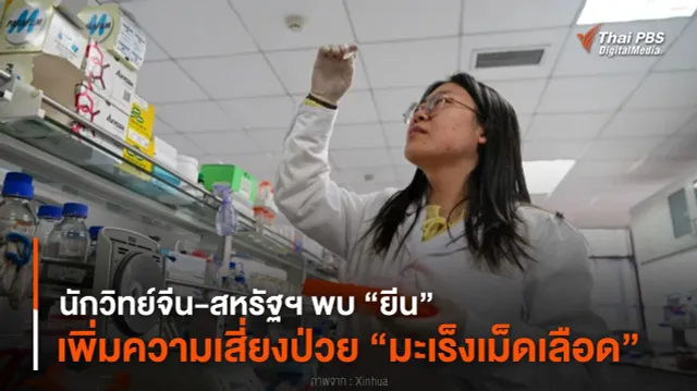 นักวิทย์จีน-สหรัฐฯ พบ “ยีน” เพิ่มความเสี่ยงป่วย “มะเร็งเม็ดเลือด”