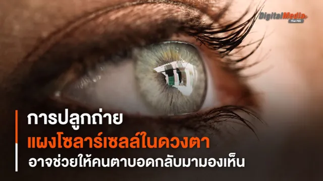 การปลูกถ่าย "แผงโซลาร์เซลล์" ในดวงตา อาจช่วยให้คนตาบอดกลับมามองเห็น