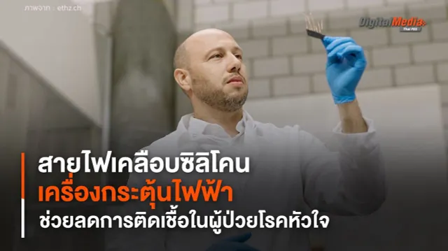 สายไฟเคลือบซิลิโคนสำหรับเครื่องกระตุ้นไฟฟ้า ช่วยลดการติดเชื้อในผู้ป่วยโรคหัวใจ
