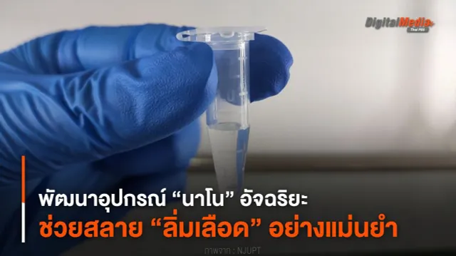 พัฒนาอุปกรณ์ “นาโน” อัจฉริยะ ช่วยสลาย “ลิ่มเลือด” อย่างแม่นยำ