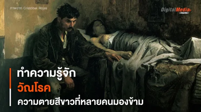 “วัณโรค” ความตายสีขาวที่หลายคนมองข้าม