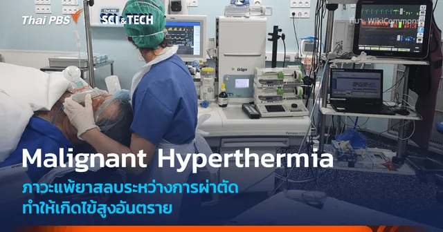Malignant Hyperthermia ภาวะแพ้ยาสลบที่ทำให้เกิดไข้สูงอันตรายระหว่างการผ่าตัด