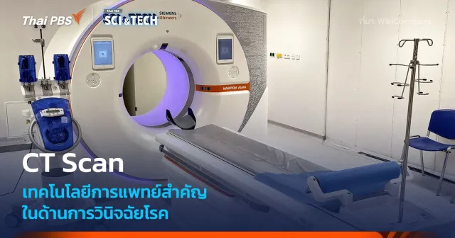 รู้จัก CT Scan หนึ่งในเทคโนโลยีการแพทย์ที่สำคัญสำหรับการวินิจฉัยโรค