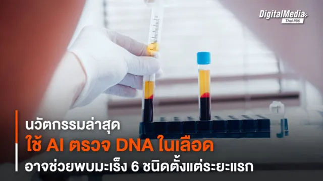 ใช้ AI ตรวจมะเร็ง ! วิเคราะห์ DNA จากเลือด อาจช่วยพบมะเร็ง 6 ชนิดตั้งแต่ระยะแรก