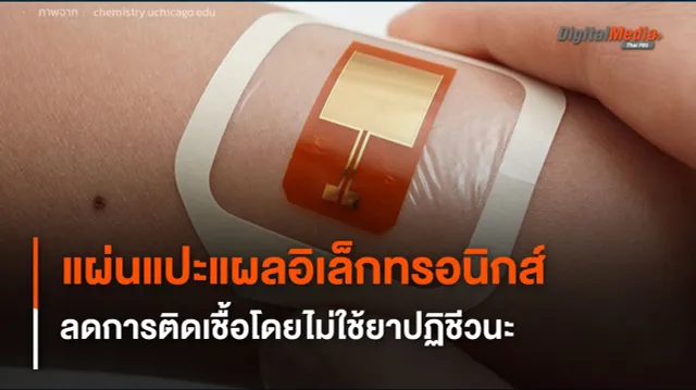แผ่นแปะแผลอิเล็กทรอนิกส์ ลดการติดเชื้อรุนแรงโดยไม่ใช้ยาปฏิชีวนะ