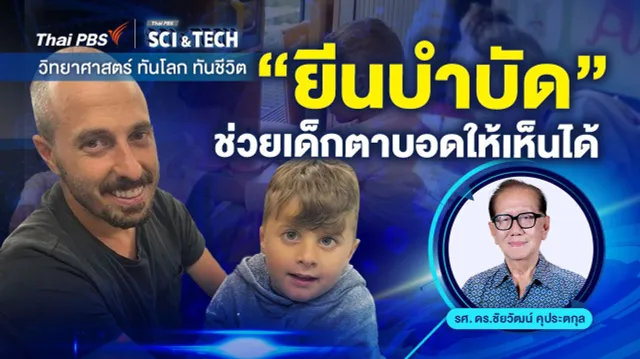 "ยีนบำบัด" ช่วยเด็กตาบอดให้เห็นได้