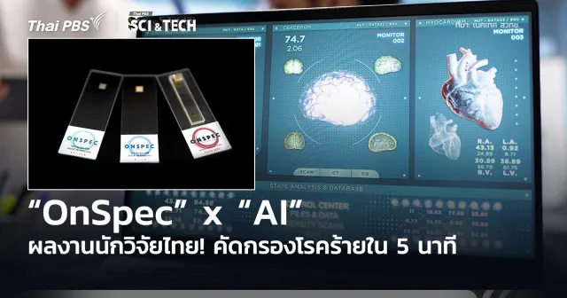 ผลงานนักวิจัยไทย! “OnSpec” x “AI” คัดกรองโรคร้ายใน 5 นาที