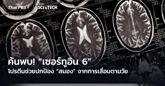 ค้นพบ! “เซอร์ทูอิน 6” โปรตีนช่วยปกป้อง “สมอง” จากการเสื่อมตามวัย