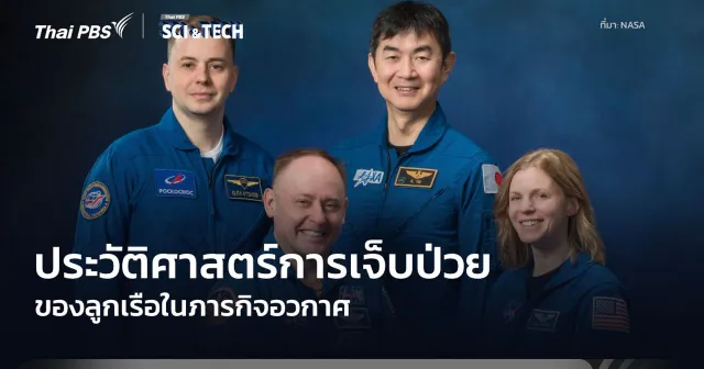 ประวัติศาสตร์ของการป่วยใน “อวกาศ”