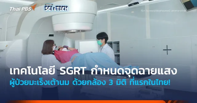 ที่แรกในไทย! นำเทคโนโลยี SGRT กำหนดจุดฉายแสงผู้ป่วยมะเร็งเต้านม ด้วยกล้อง 3 มิติ