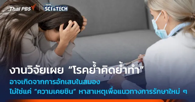 “โรคย้ำคิดย้ำทำ” อาจเกิดจากการอักเสบในสมอง ไม่ใช่แค่ “ความเคยชิน”