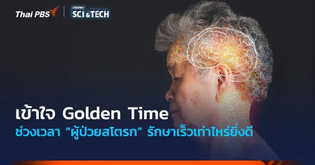 เข้าใจ Golden Time ช่วงเวลา “ผู้ป่วยสโตรก” รักษาเร็วเท่าไหร่ยิ่งดี