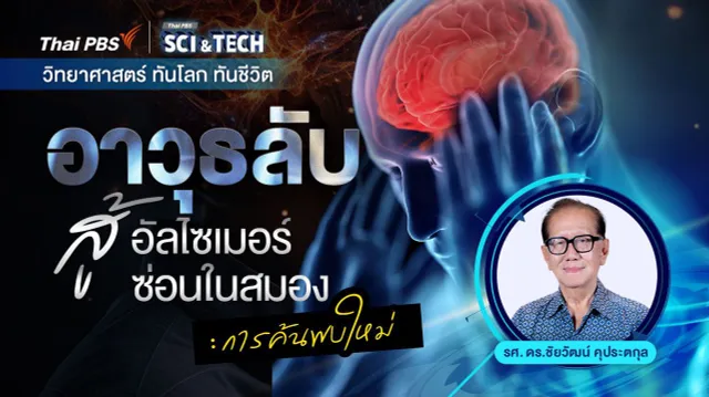 อาวุธลับสู้อัลไซเมอร์ซ่อนในสมอง : การค้นพบใหม่