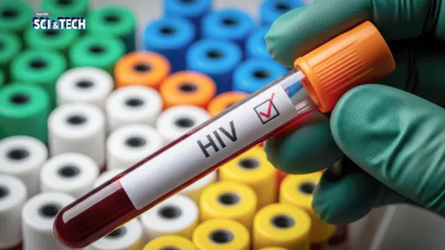 ผสาน 3 การรักษาเข้าด้วยกัน! สามารถกำจัดเชื้อ HIV ในลูกลิงแรกเกิดได้ 100%