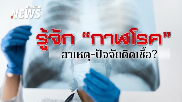 เรื่องควรรู้ "กาฬโรค" ติดต่ออย่างไร อาการสำคัญ ใครเสี่ยง-ป้องกันอย่างไร