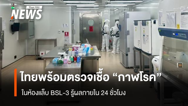 กรมวิทย์ฯ พร้อมตรวจ "กาฬโรค" รู้ผลใน 24 ชั่วโมง หากพบผู้ป่วยต้องสงสัยในไทย 