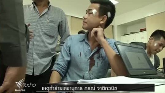 ตร.เร่งหาคนร้ายทำร้ายเลขานุการ กรณ์ จาติกวนิช