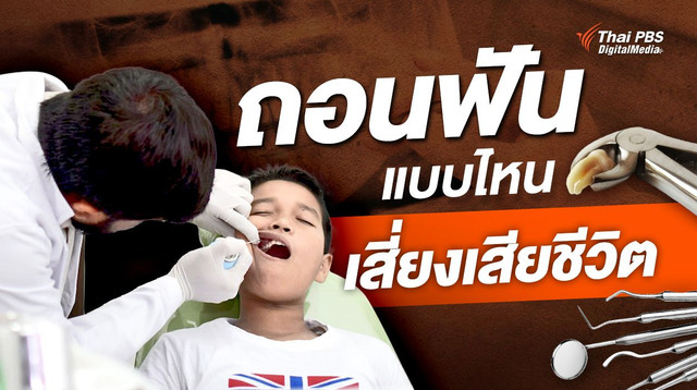 “ถอนฟัน” แบบไหน เสี่ยงเสียชีวิต มองรอบด้าน “ได้” มากกว่า “เสีย”