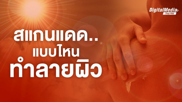 สแกนแดด...แบบไหนทำลายผิวและสุขภาพคุณ