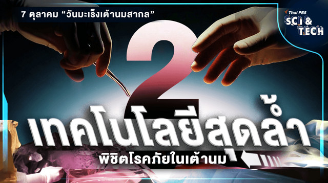 ชวนรู้จัก 2 เทคโนโลยีสุดล้ำ พิชิตโรคภัยในเต้านม
