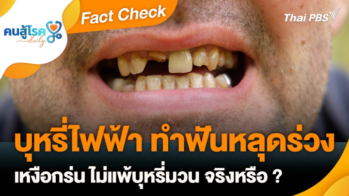 Fact Check :  บุหรี่ไฟฟ้า ทำฟันหลุดร่วง-เหงือกร่น ไม่แพ้บุหรี่มวน จริงหรือ ?