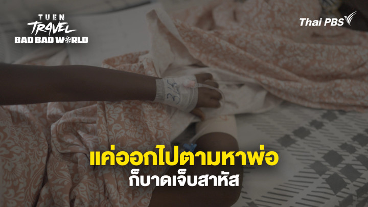 แค่ออกไปตามหาพ่อ ก็บาดเจ็บสาหัส