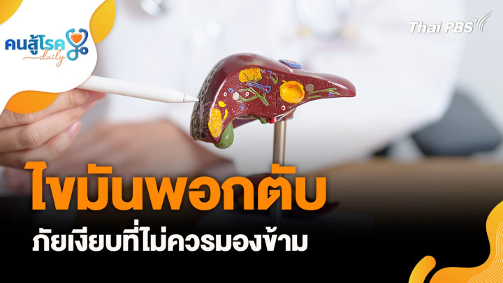 ไขมันพอกตับ ภัยเงียบ, เปิดฝาขวดไม่ออก = แก่และอายุสั้น จริงหรือ ?