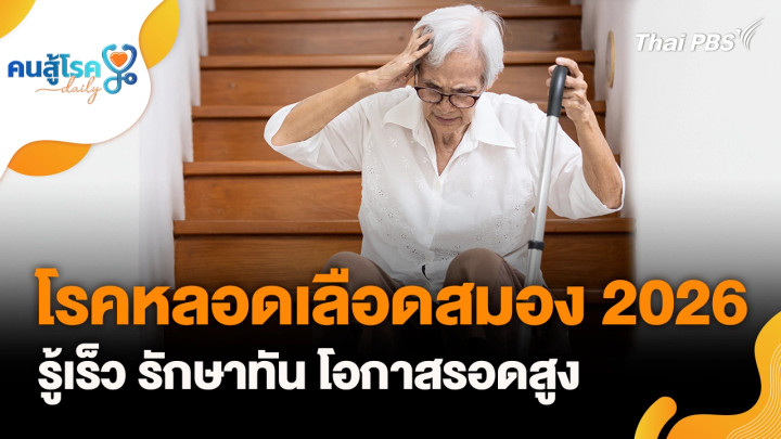 โรคหลอดเลือดสมอง, จิบน้ำขิงร้อน บรรเทาไมเกรน จริงหรือ ?