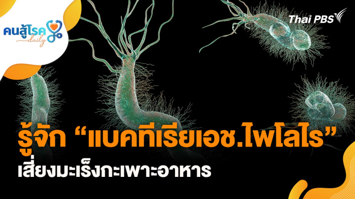 รู้จัก “แบคทีเรียเอช.ไพโลไร” เสี่ยงมะเร็งกะเพาะอาหาร, 