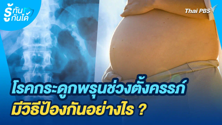 รู้ทันกันได้ : โรคกระดูกพรุนช่วงตั้งครรภ์...มีวิธีป้องกันอย่างไร ?