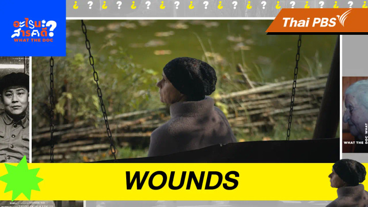Wounds