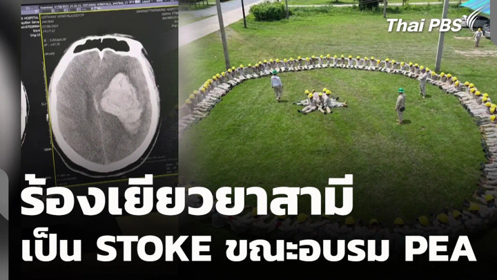 ร้องเยียวยาสามี เป็น STOKE ขณะอบรม PEA