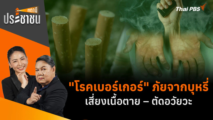 "โรคเบอร์เกอร์" ภัยจากบุหรี่ เสี่ยงเนื้อตาย – ตัดอวัยวะ