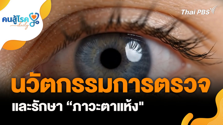 นวัตกรรมการตรวจและรักษา “ภาวะตาแห้ง"