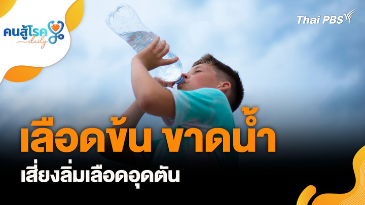 เลือดข้น ขาดน้ำ เสี่ยงลิ่มเลือดอุดตัน