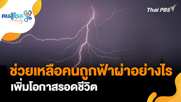 ช่วยคนถูกฟ้าผ่าอย่างไร ให้รอด, ใส่ข้อเทียม หรือเหล็กดามกระดูก กลายเป็นสายล่อฟ้า จริงหรือ ?