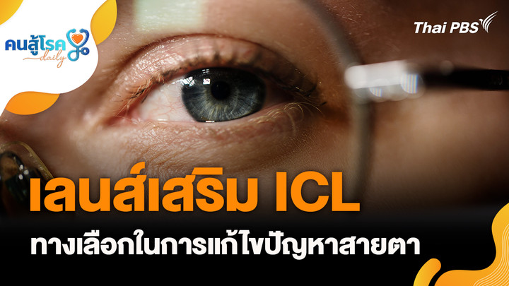เลนส์เสริม ICL ทางเลือกในการแก้ไขปัญหาสายตา