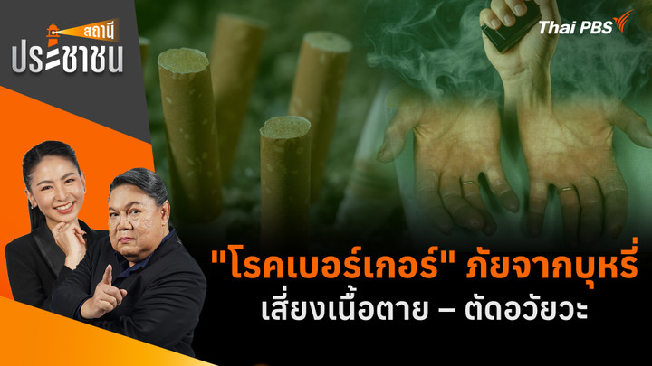 "โรคเบอร์เกอร์" ภัยจากบุหรี่ เสี่ยงเนื้อตาย – ตัดอวัยวะ  