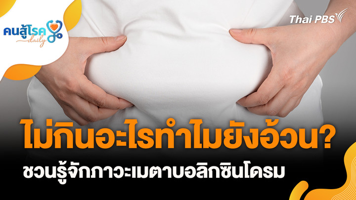 ชวนรู้จักภาวะเมตาบอลิกซินโดรม, "ไมเกรน" ไม่จำเป็นต้องปวดหัว แต่บ้านหมุนจริงหรือ?